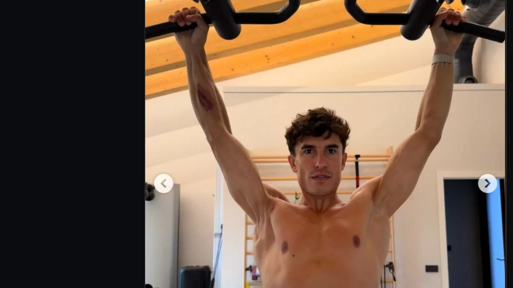 Marc Marquez ve sağ kolundaki fiziksel kısıtlamalar